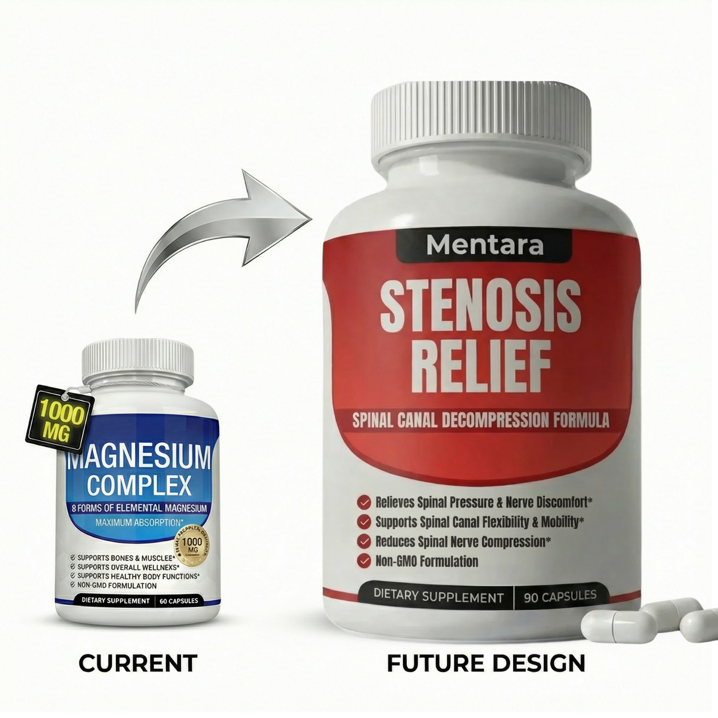 Mentara™ Stenosis Relief